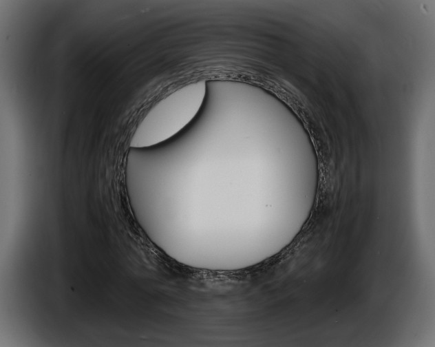 X0000086910774200704161008