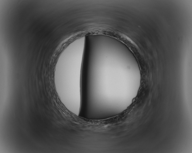 X0000086910775200704161008