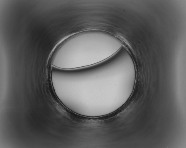 X0000086910779200704161008