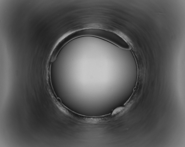 X0000086910854200704161007