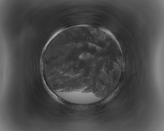 X0000086910859200704161007