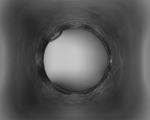 X0000086910867200704161007