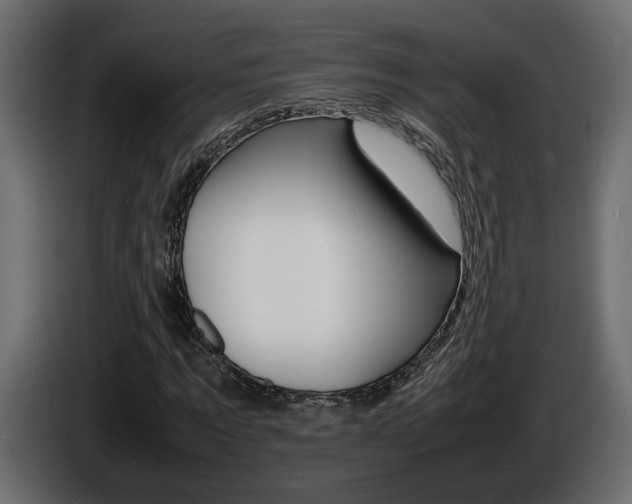 X0000086910869200704161007