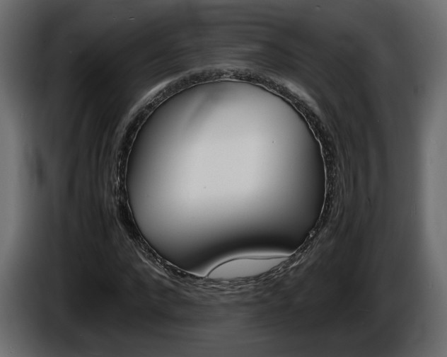 X0000086910872200704161007