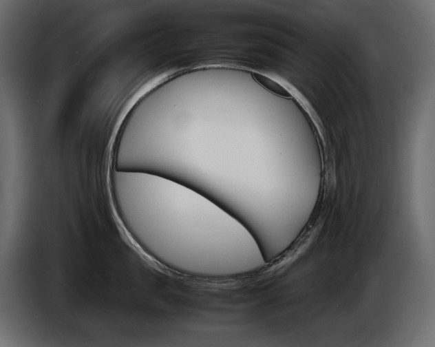 X0000086910957200704161006