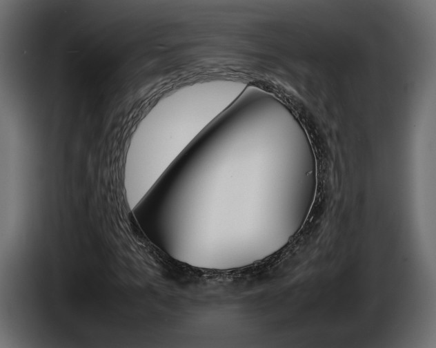 X0000086910965200704161005