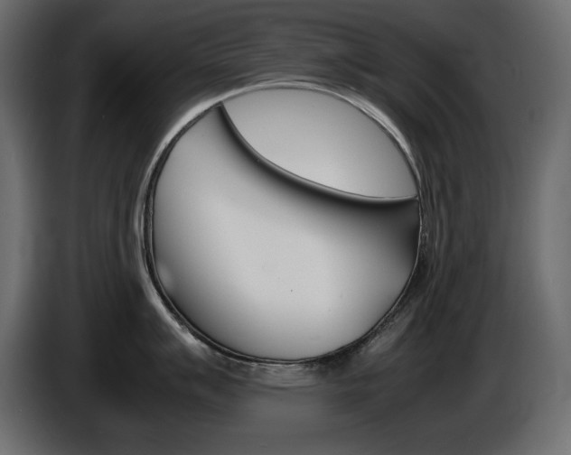 X0000086911007200704161005