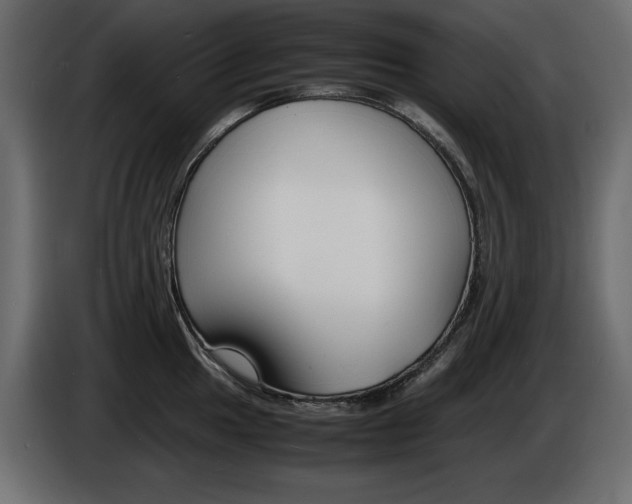 X0000086911049200704161005