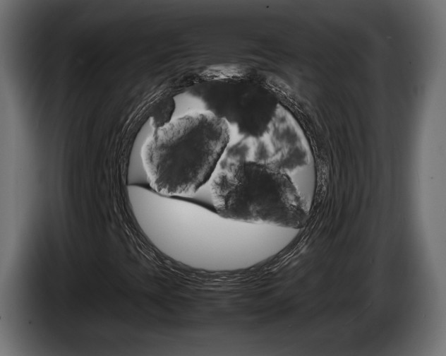 X0000086911393200704160958