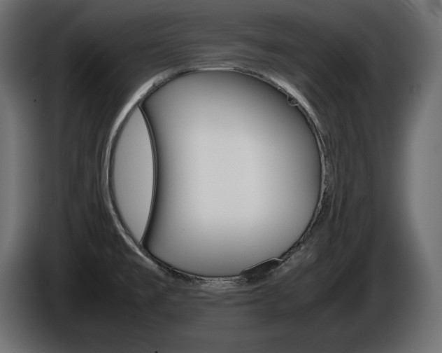 X0000086911477200704160958