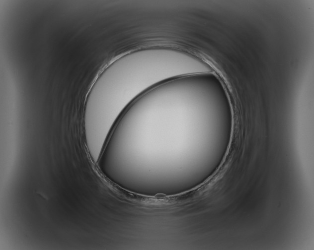 X0000086911481200704160958