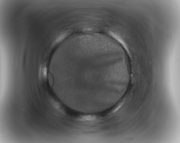 X0000086910067200704301045