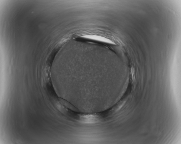 X0000086910237200704301043