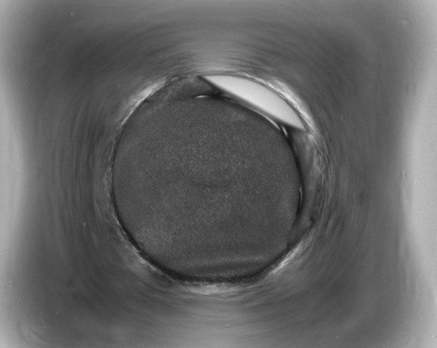 X0000086910385200704301041