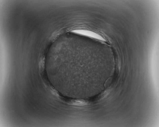 X0000086910475200704301041