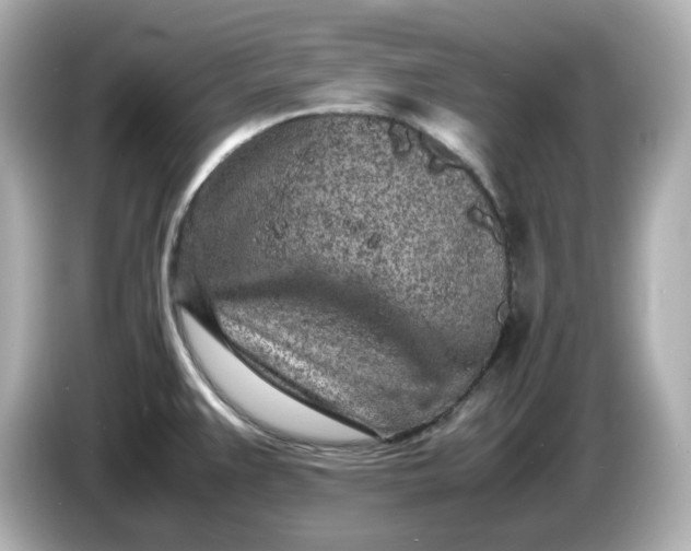 X0000086911383200704301028