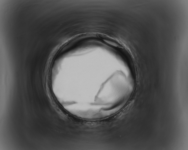 X0000086910145200705071311