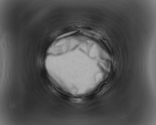 X0000086910285200705071310