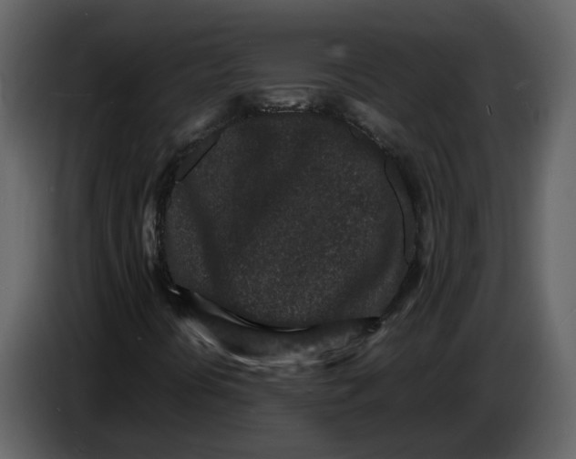 X0000086911394200705071254