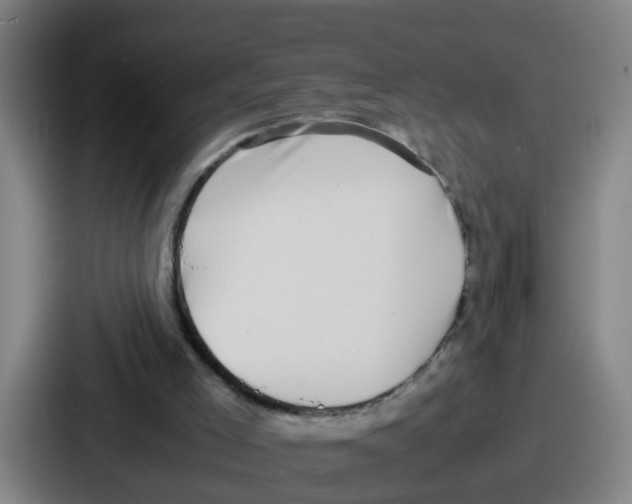 X0000086910005200705141711