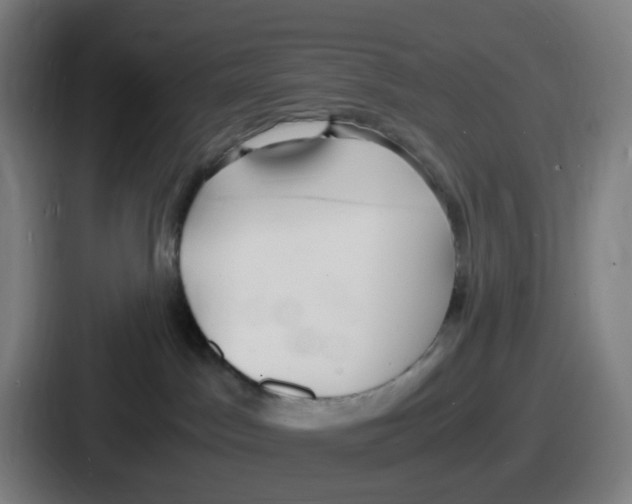 X0000086910045200705141711