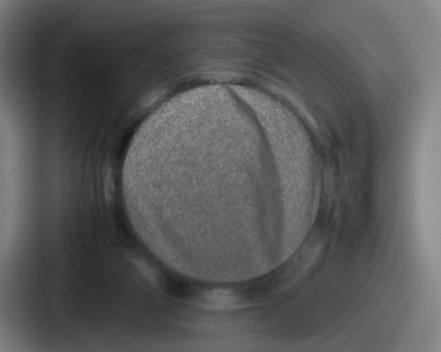 X0000086910114200705141710