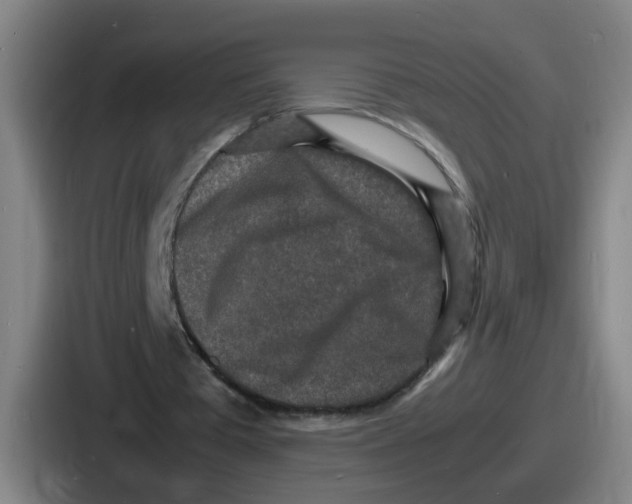 X0000086910385200705141707