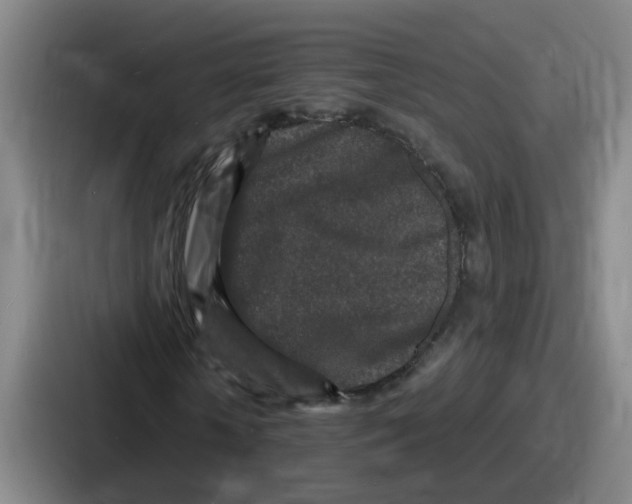 X0000086910818200705141700