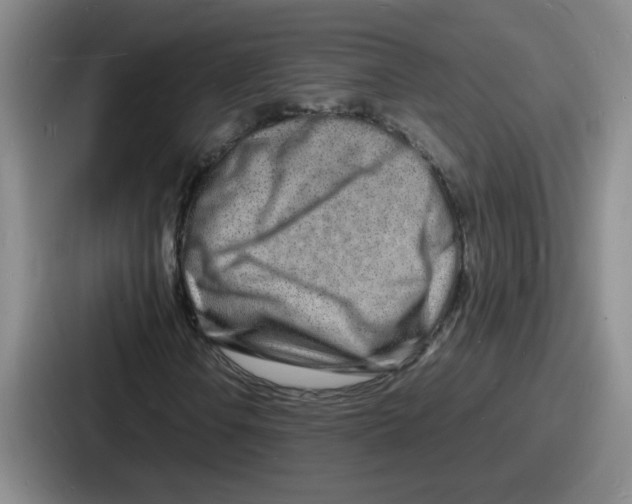 X0000086911106200705141657