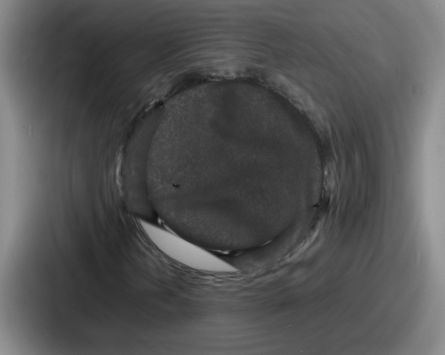 X0000086911202200705141655