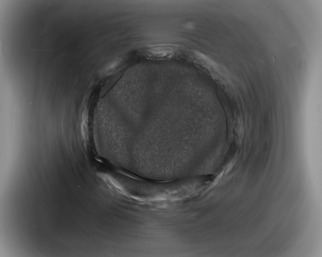 X0000086911394200705141653