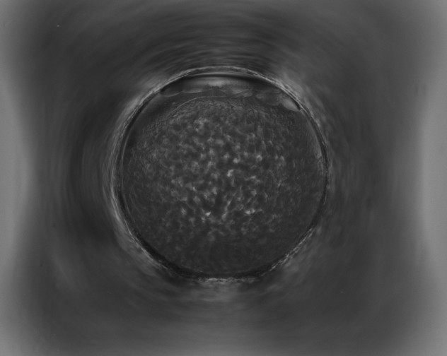 X0000086920145200704161410