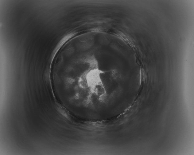 X0000086920147200704161410