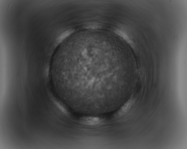 X0000086920159200704161410