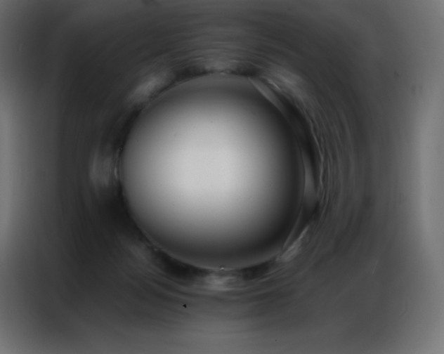 X0000086920172200704161410