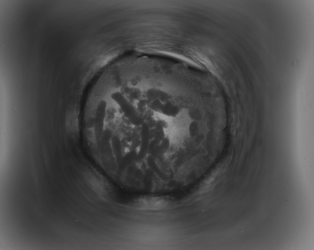 X0000086920299200704161408