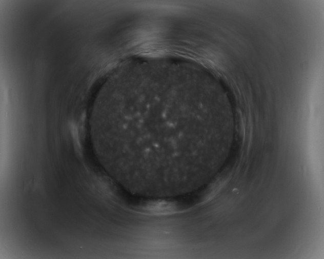 X0000086920319200704161408