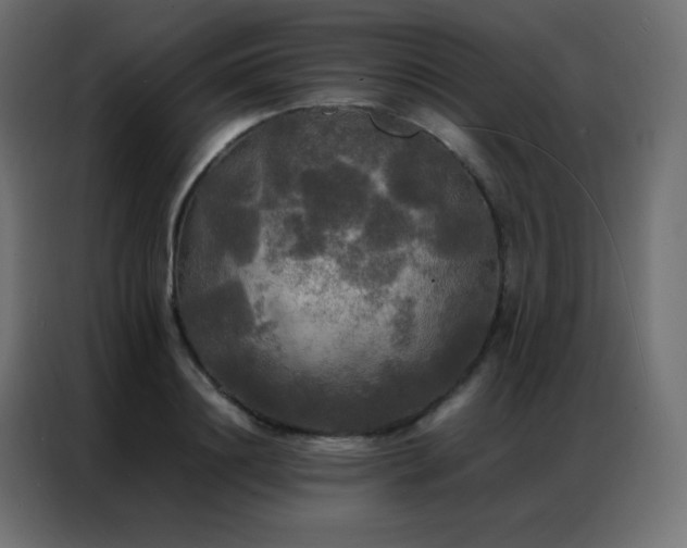 X0000086920844200704161401