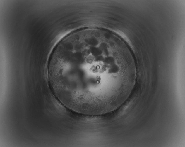 X0000086920887200704161400