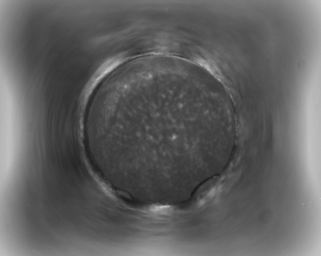 X0000086920055200704301105