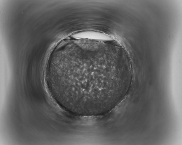 X0000086920145200704301104