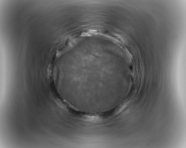 X0000086920284200704301103