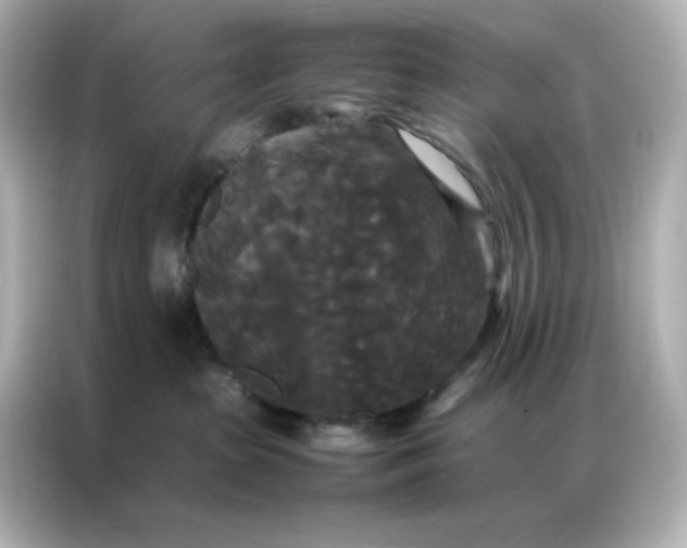 X0000086920285200704301103