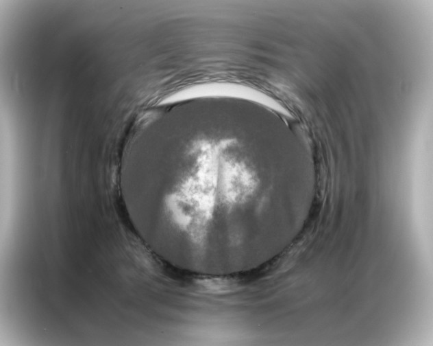 X0000086920417200704301101
