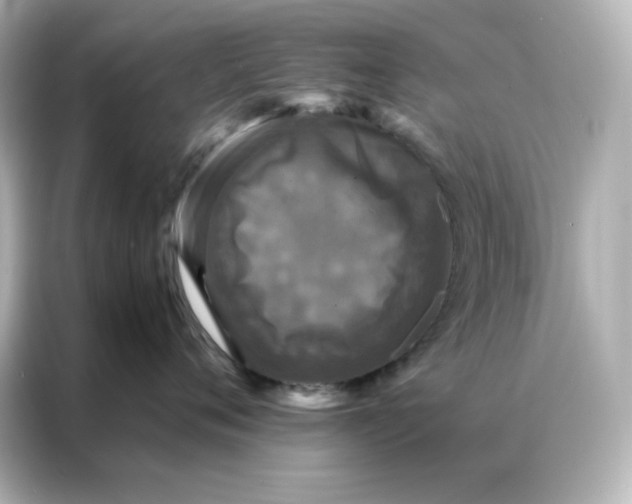 X0000086920720200704301057