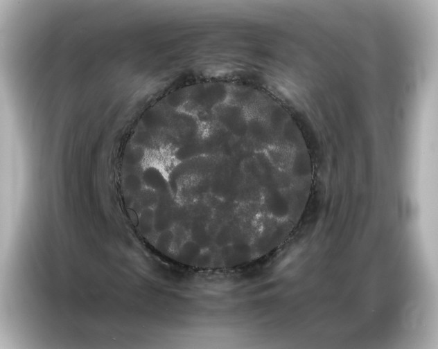 X0000086920817200704301055
