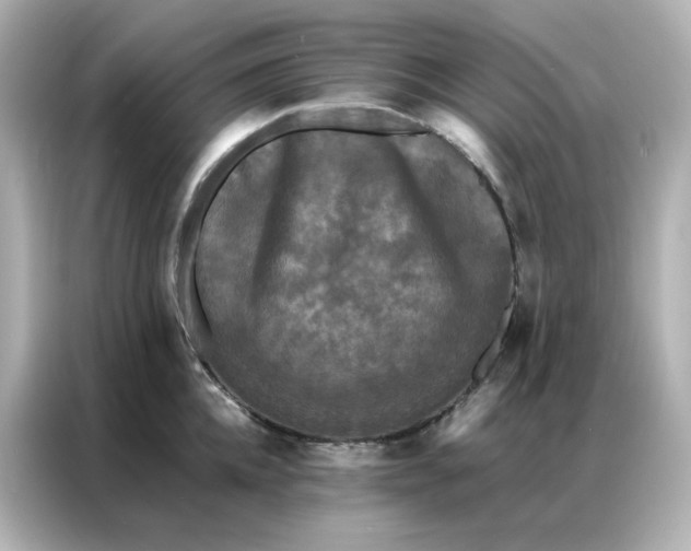 X0000086920952200704301054