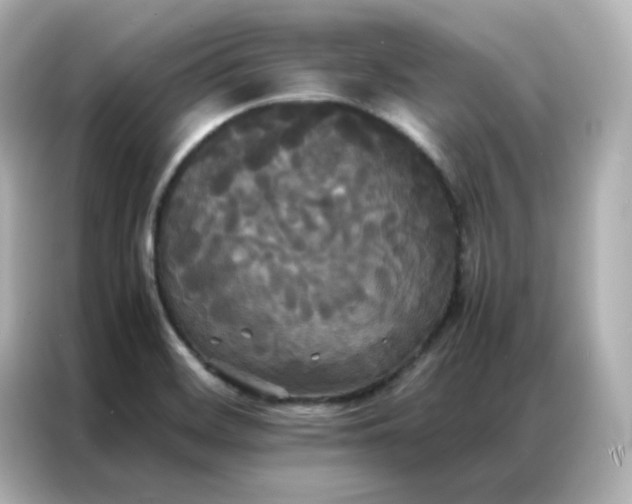 X0000086921468200704301047