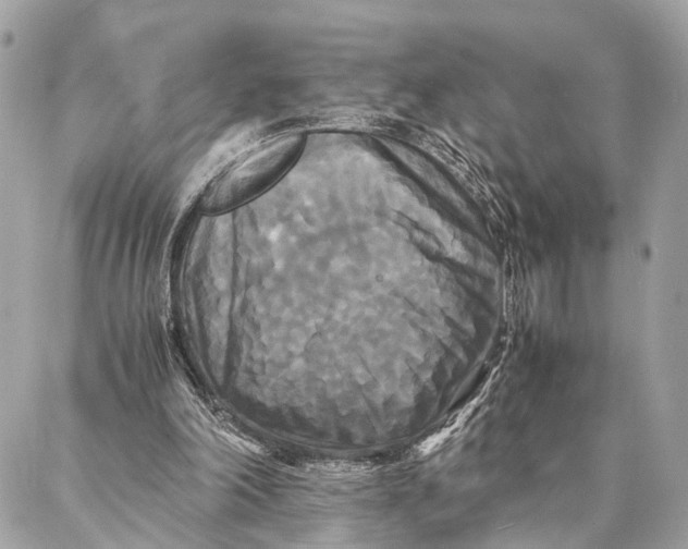 X0000086920198200705071336