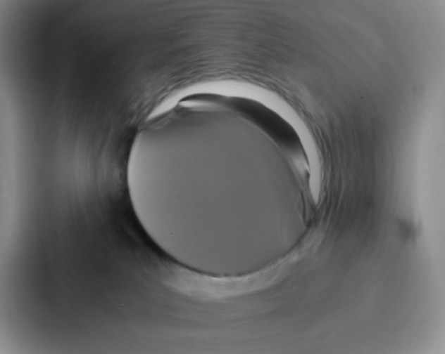 X0000086920039200705141731